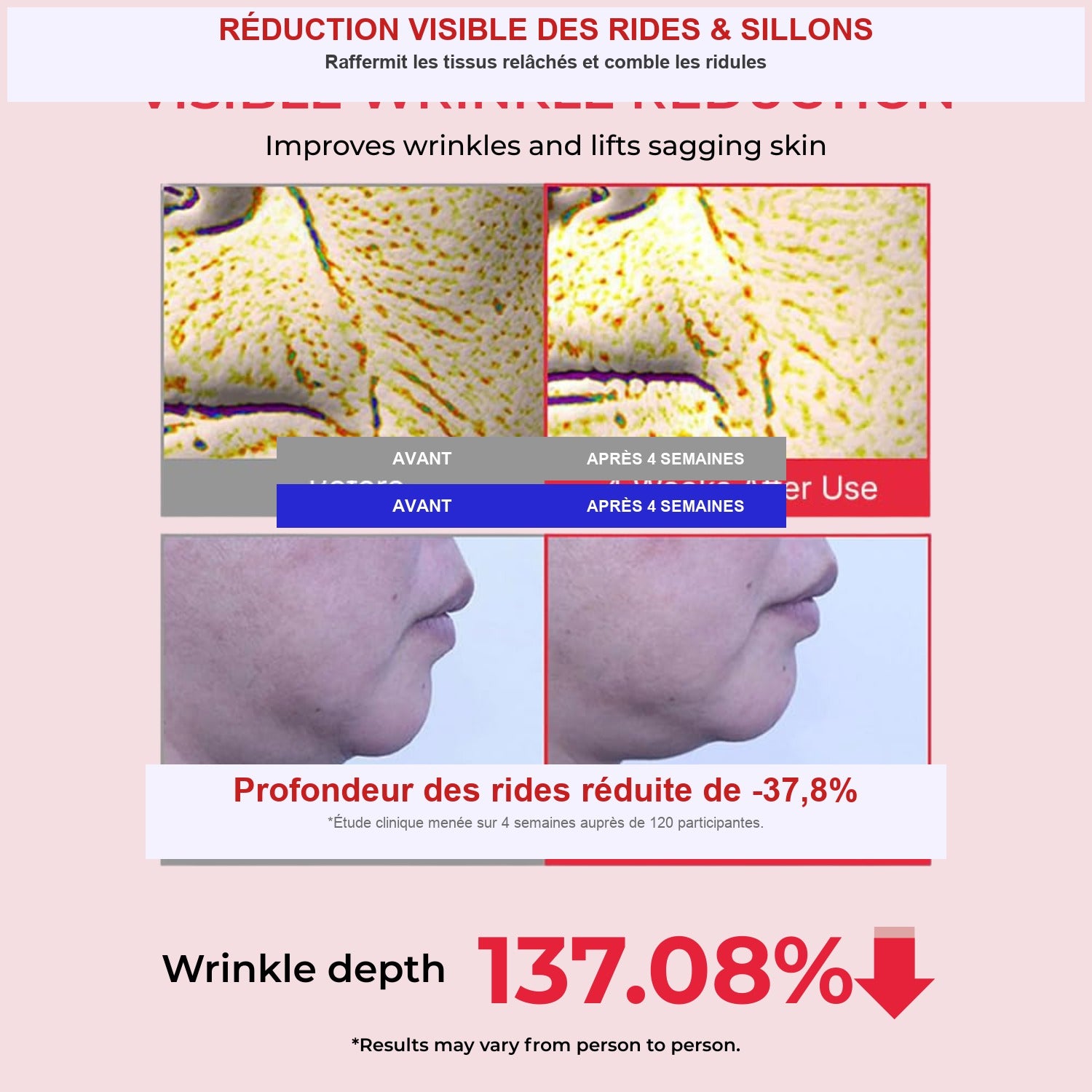 Étude clinique réduction profondeur rides
