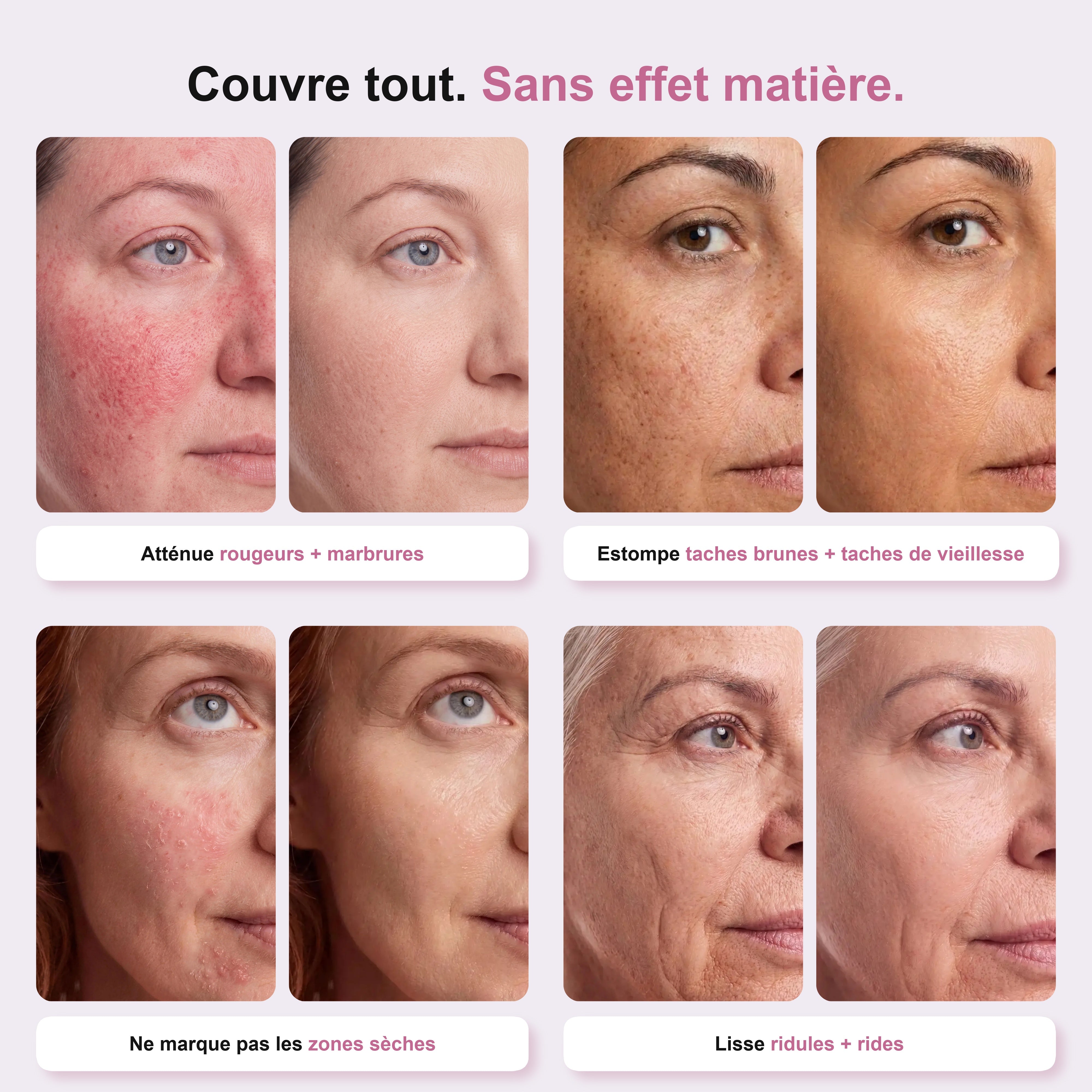 Résultats Avant / Après